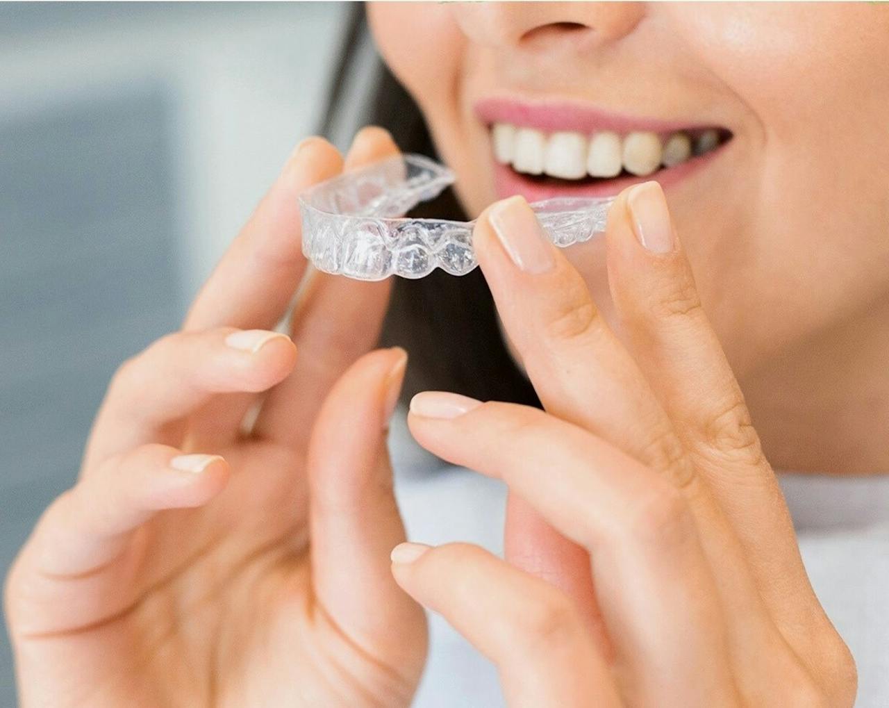 Prozirna aligner udlaga